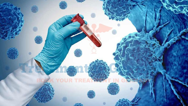 Dendritic Cell Therapy Treatment  in Germany