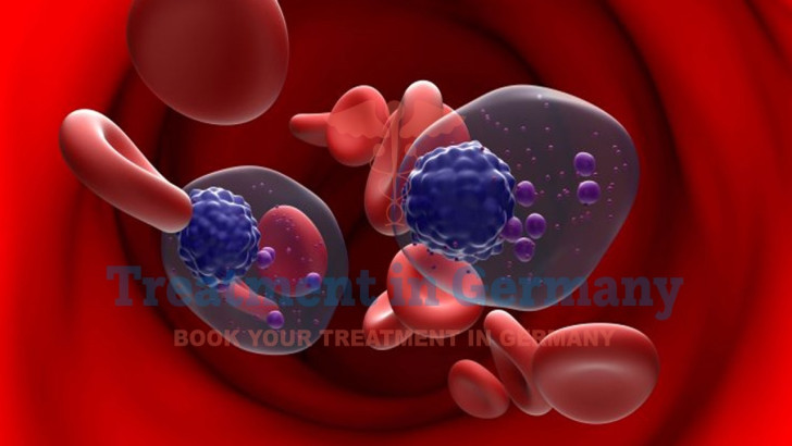 Advanced Multiple Myeloma Treatment in Germany