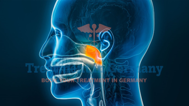 Advanced Nasopharyngeal Cancer Treatment in Germany