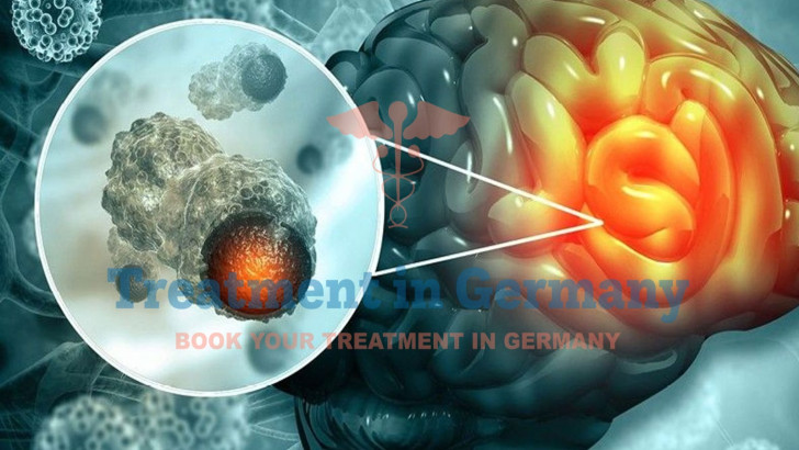 Innovative Methods of Brain Cancer Treatment in Germany