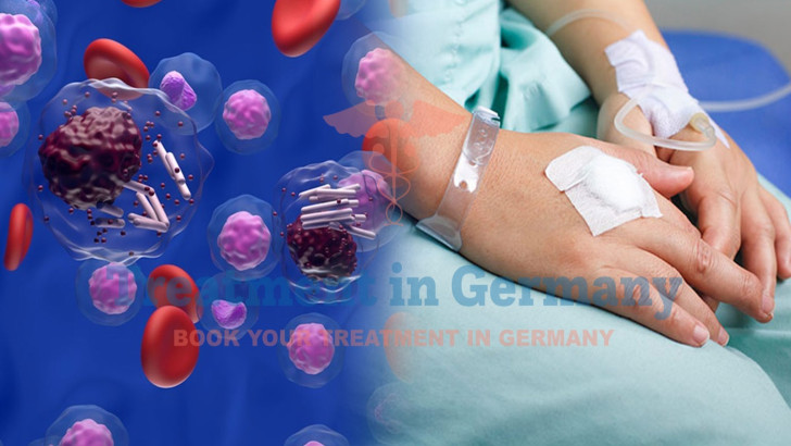 Treatment Options for Chronic Lymphocytic Leukemia (CLL) in Germany