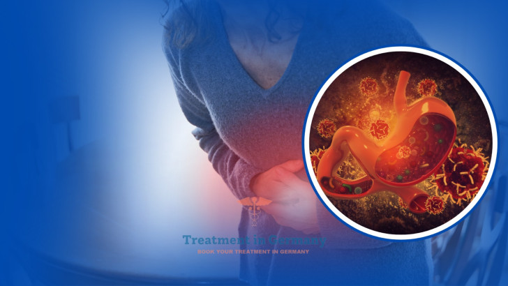 Treatment of Stage 4 Stomach Cancer in Germany