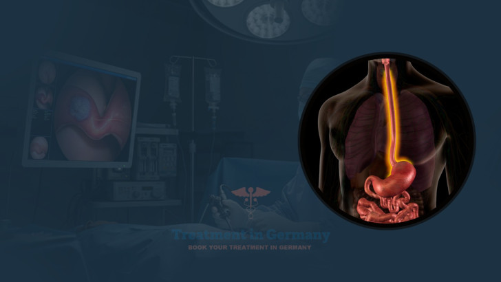 Esophageal Cancer Treatment Options in Germany