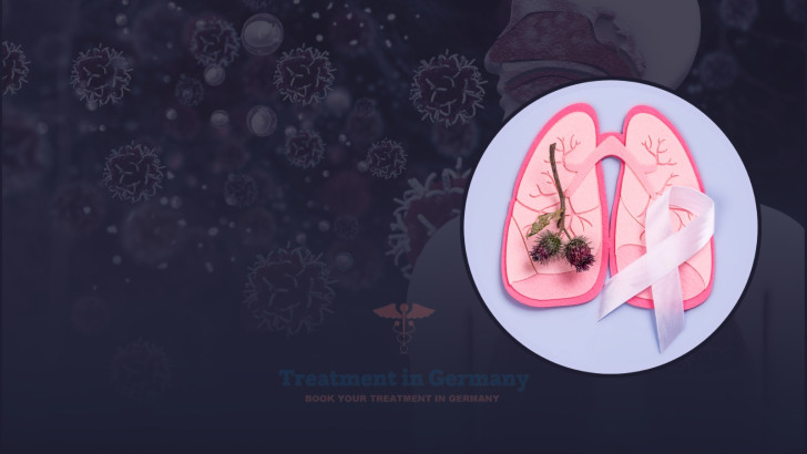 Prostate Cancer Treatment Options in Germany