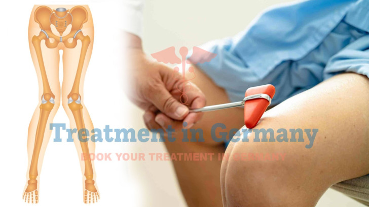 Genu Valgum (Knock Knees) Treatment in Germany