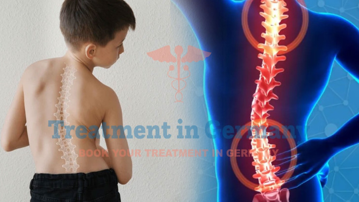 Pediatric Scoliosis Treatment in Germany