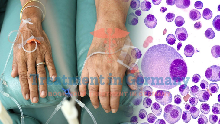Multiple Myeloma Treatment in Germany