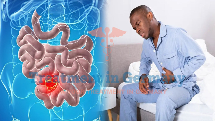 Duodenal Cancer: Exploring Latest Treatment Options, Symptoms, and Diagnosis in Germany