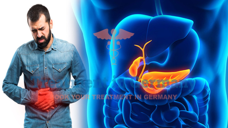 TACE Treatment for Stage 4 Bile Duct Cancer in Germany