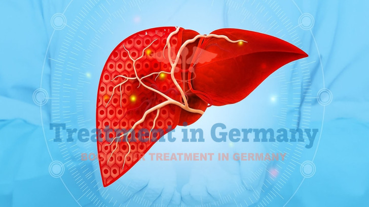Treatment of stage 4 liver cancer in Germany