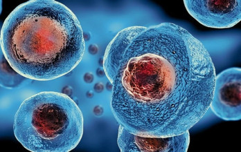 Treatment with Stem cell in Germany