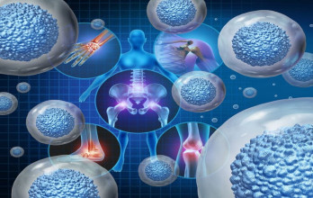 Dendritic Cell Therapy in Germany
