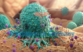 Cancer Treatment in Germany