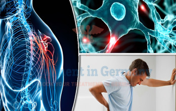 Multiple Sclerosis (MS) Treatment in Germany
