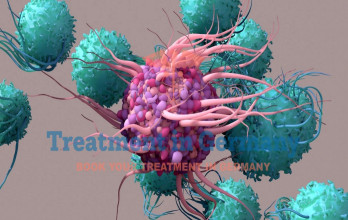 Dendritic Cell Therapy Treatment in Germany