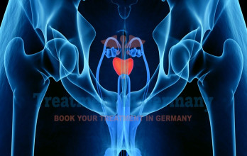 Advanced Prostate Cancer Treatment in Germany