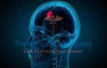 Advanced Stage 4 Brain Cancer Treatment in Germany