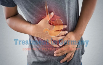 Advanced Stomach (Gastric) Cancer Treatment in Germany