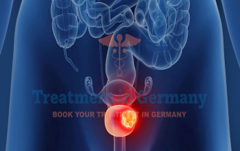 Stage 4 Bladder Cancer Treatment in Germany