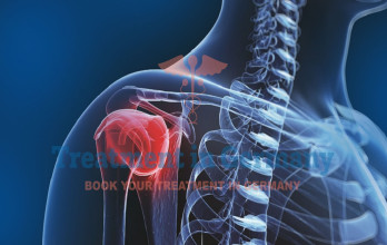 New Immunotherapy for Osteosarcoma: Treatment with Dendritic Cell Therapy