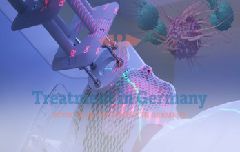Radiation Therapy in Germany: Advancing with Dendritic Cell Therapy in Treatment Plans