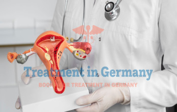 Advanced Treatment of stage 4 ovarian cancer in Germany