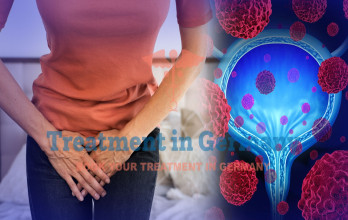 Immunotherapy treatment for bladder cancer in Germany