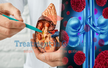 From Dialysis to Dendritic Cell Therapy: A Kidney Cancer Journey in Germany
