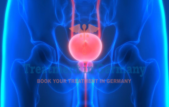 The German Protocol for Bladder Cancer Treatment Using Dendritic Cell Therapy
