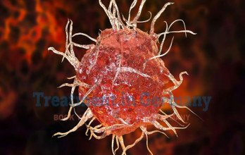Pioneering Research: Germany’s Contributions to Universal Dendritic Cell Cancer Solutions