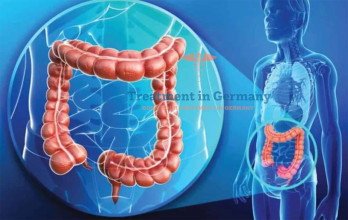 Colorectal Cancer: Latest Advancements in Treatment in Germany for 2025