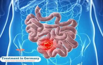 Survival Rates and Prognosis for Colorectal Cancer Patients with Liver Metastases