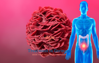 Lutetium-177 PSMA Therapy for Prostate Cancer Treatment in Germany