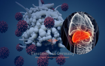 Fighting Liver Metastases with Dendritic Cell Therapy in Germany