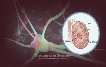 Dendritic Cell Therapy for Testicular Cancer in Germany