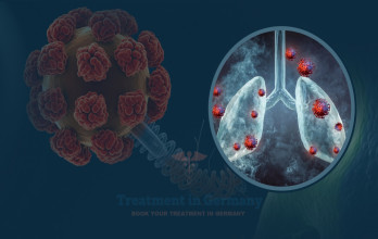 TACP Therapy for Lung Cancer in Germany