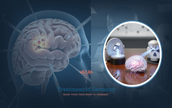 Astrocytoma Treatment Options in Germany