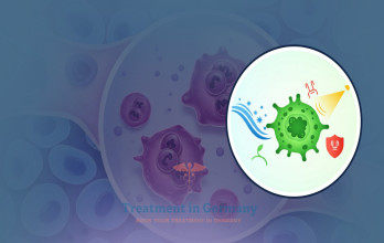 Hodgkin Lymphoma Treatment Options in Germany