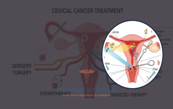 Cervical Cancer Treatment Options in Germany