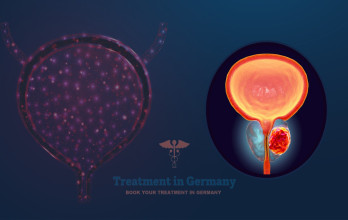 Endometrial (Uterine) Cancer Treatment Options in Germany