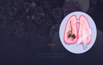 Prostate Cancer Treatment Options in Germany