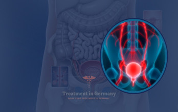 Bladder Cancer Treatment Options in Germany for USA Patients