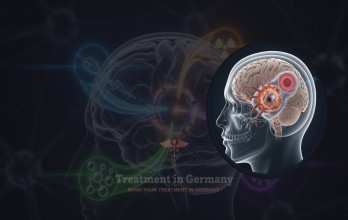 Glioblastoma Treatment Options in Germany for UK Patients