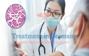 Adenocarcinoma Treatment Options in Germany