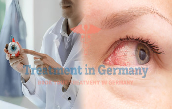 Conjunctivitis (pink eye) Treatment in Germany