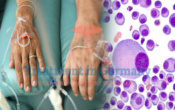 Multiple Myeloma Treatment in Germany