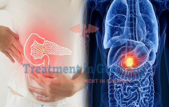 Pancreatic Cancer Treatment in Germany