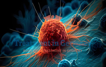 How Germany Uses Dendritic Cells to Fight Cancer