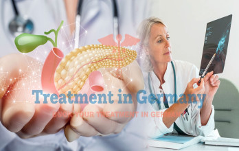 Understanding Tumor Markers in Pancreatic Cancer: Germany’s Approach to Diagnosis and Monitoring