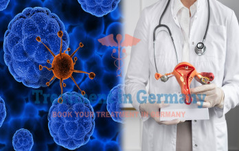 Dendritic Cell Therapy for Stage 4 Ovarian Cancer in Germany